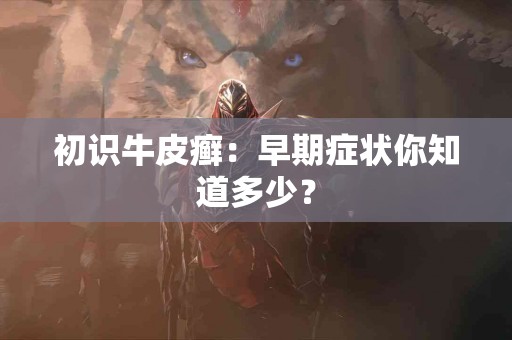 初识牛皮癣:早期症状你知道多少? 初识牛皮癣:早期症状你知道多少?